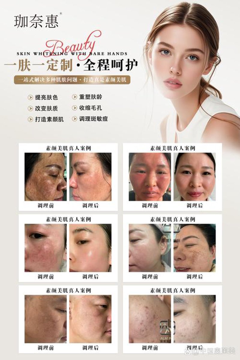 让肌肤焕然一新的秘密武器——皮肤管理全解析